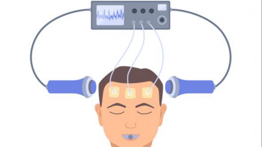 Aplicación de Terapia Electroconvulsiva (TEC): paciente con electrodos en la frente conectado a un dispositivo que muestra una onda en pantalla.