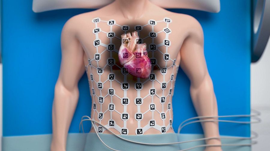 Mapeo del Corazón en el Gregorio Marañón