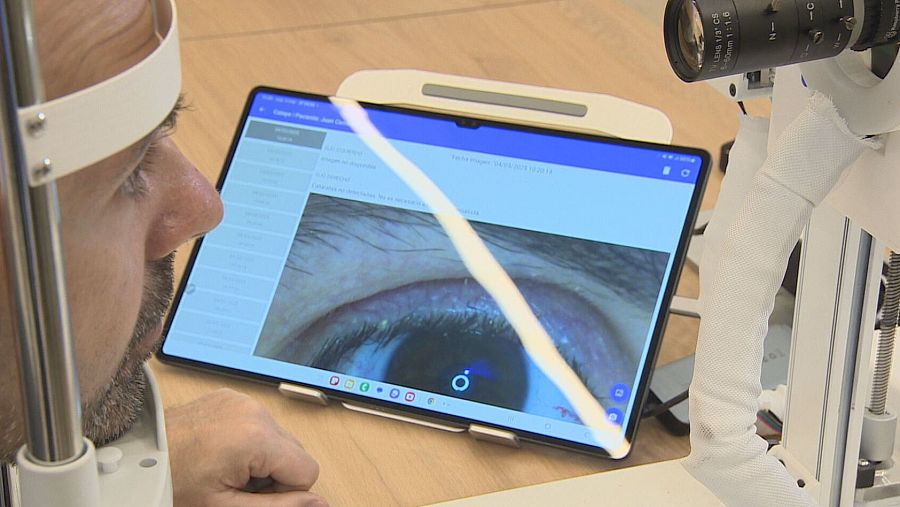 Examen ocular con dispositivo y tablet mostrando imagen ampliada del ojo.  Posible uso del software CatEye para análisis.