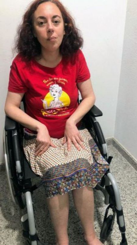 Almudena Santos es una paciente de Lugo con una endometriosis muy avanzada.