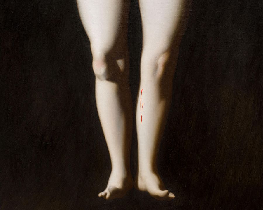 Piernas pálidas con manchas rojas sobre fondo oscuro.  El título 