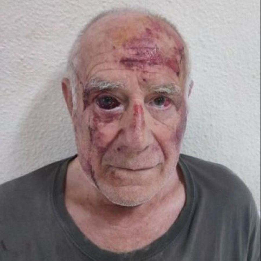 Imagen de Domingo, un hombre de 68 años, agredido en Torre Pacheco por un grupo de jóvenes