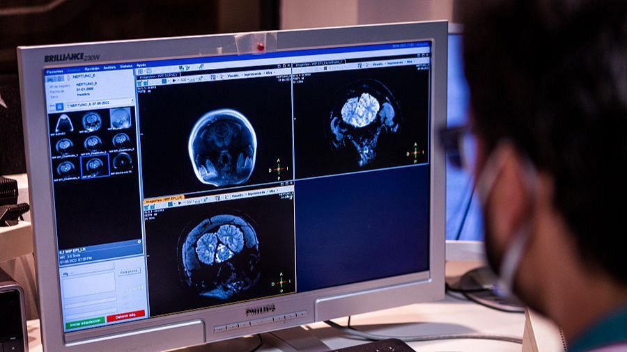 L'Hospital La Fe de València va ser el primer en coordinar l'EUCAIM.