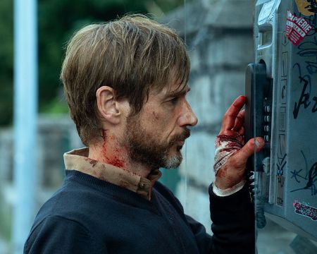 Hombre con heridas sangrantes en el cuello y mano vendada, marcando un teléfono público.  Posible víctima de agresión.