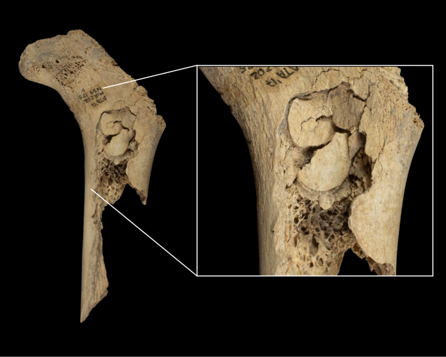 El fémur de un niño, con marcas de haber sido percutido para extraer el tuétano