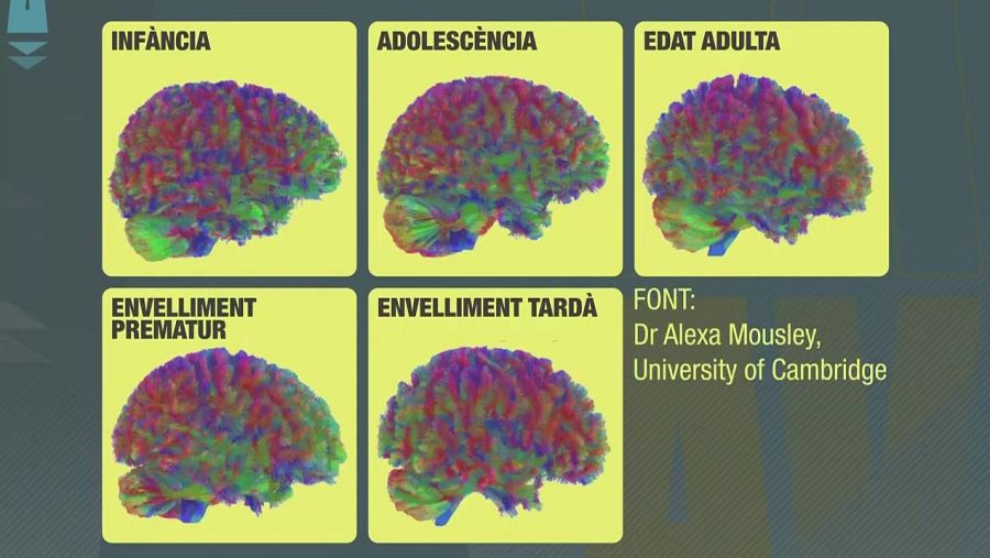 El cervell passa per cinc etapes: infància, adolescència, edat adulta, envelliment prematur i envelliment tardà.