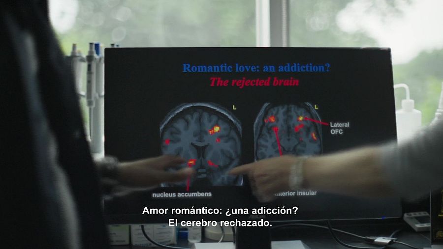 Escáner cerebral que muestra las áreas activadas en el amor y el rechazo