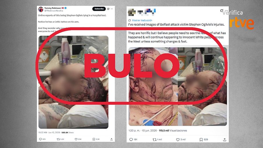 Mensaje que difunde la falsa idea de que la foto muestra a la víctima del ataque de Belfast