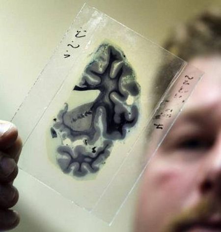 Una muestra microscópica de un cerebro humano