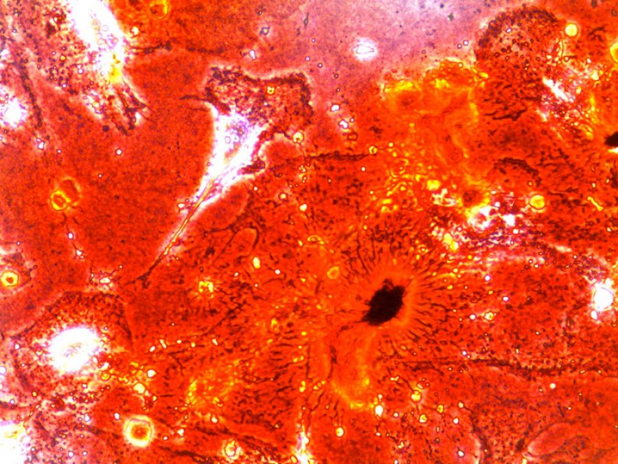 Células óseas obtenidas a partir de iPS de pacientes con el síndrome de Néstor-Guillermo.