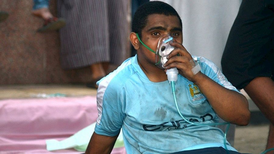 Un herido en el incendio en Jazan (Arabia Saudí) recibe atención médica. REUTERS/Defensa Civil saudí