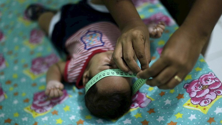 Un bebé de dos meses nacido con microcefalia en Ipojuca, Brasil. REUTERS/Ueslei Marcelino