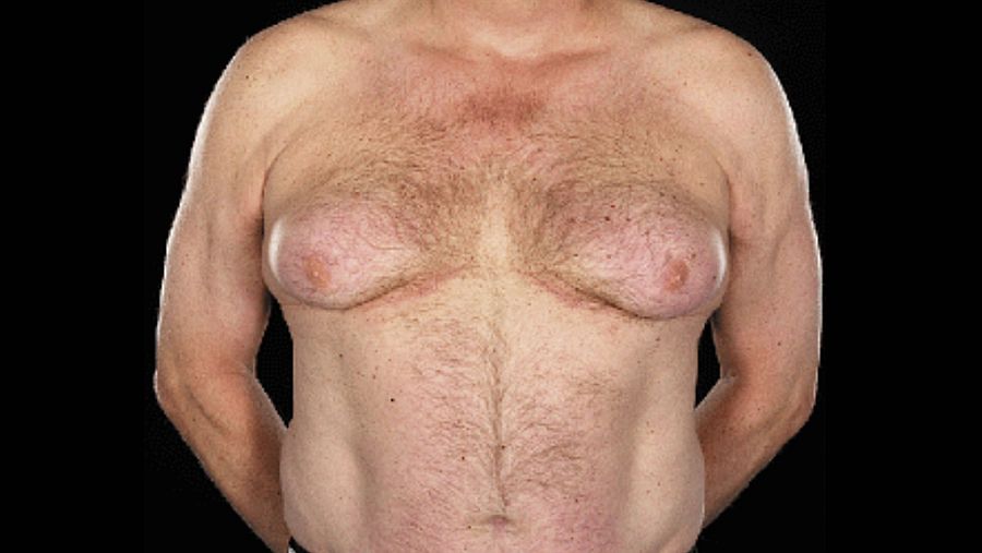 Los pechos al descubierto