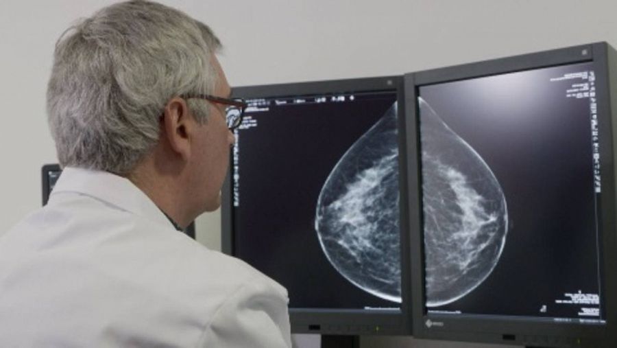 interpretar mamografia