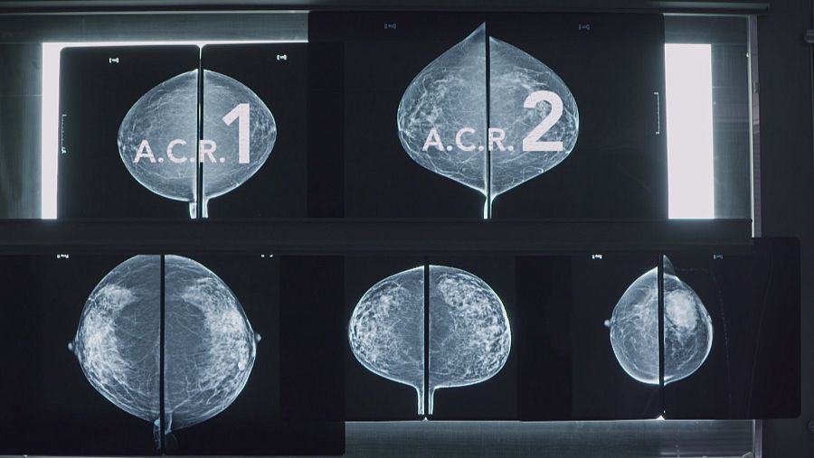 Los pechos al descubierto