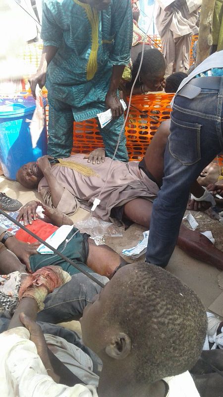 Varios de los heridos en el bombardeo del Ejército nigeriano contra un campo de refugiados