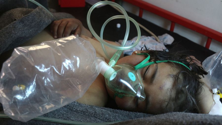 Niño sirio herido en el ataque con gas este martes en Jan Sheikhun, ciudad en manos rebeldes en la provincia siria de Idlib