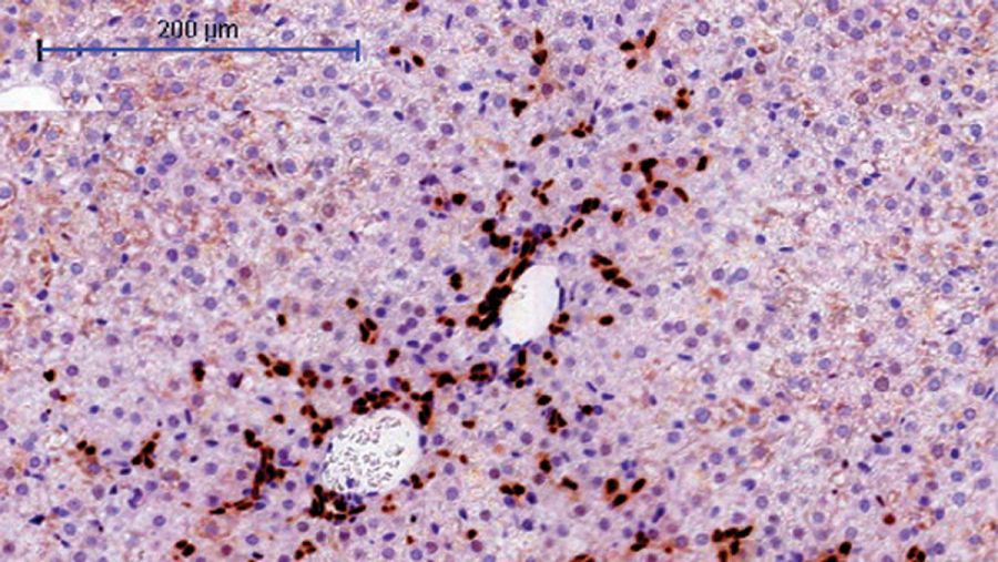 Sección del hígado de un modelo de ratón en el que los hepatocitos expresan el oncogen URI. CNIO