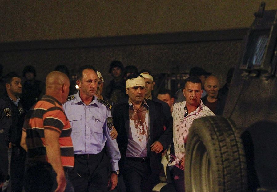 Macedonian police escorts injured members of the parliament including Social Democratic leader Zoran Zaev