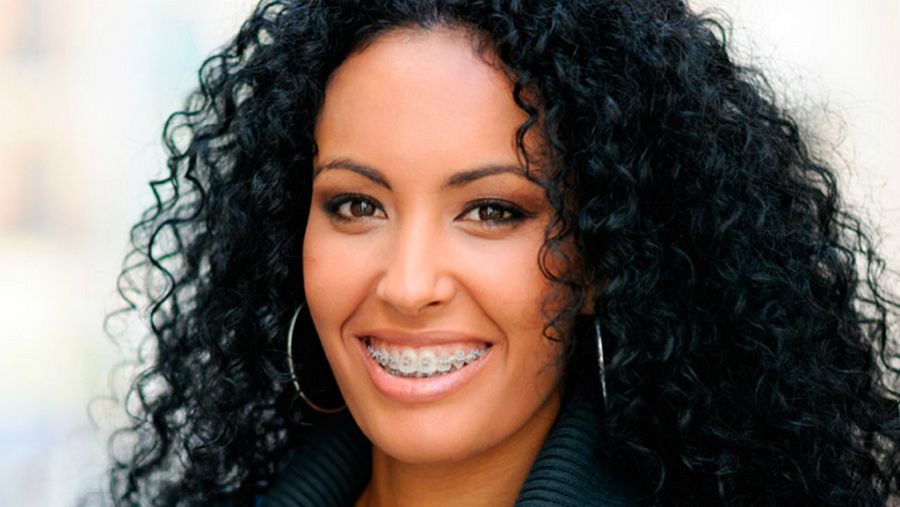 Los brákets ya no son cosa de niños