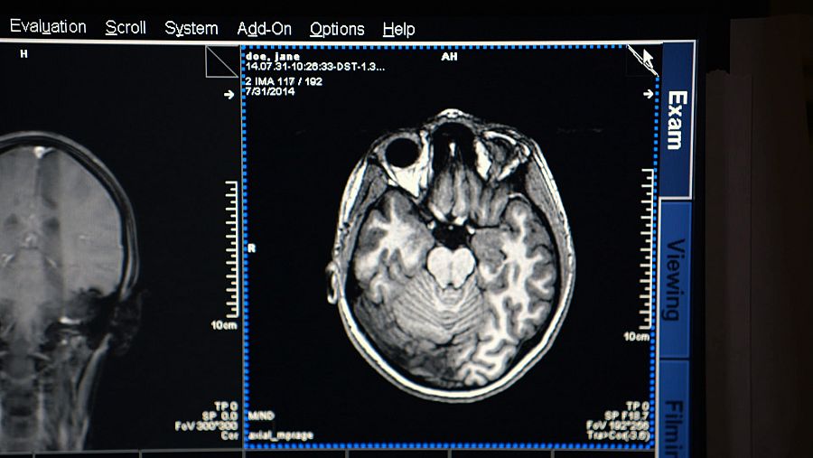 Depresión: escapar de la tristeza