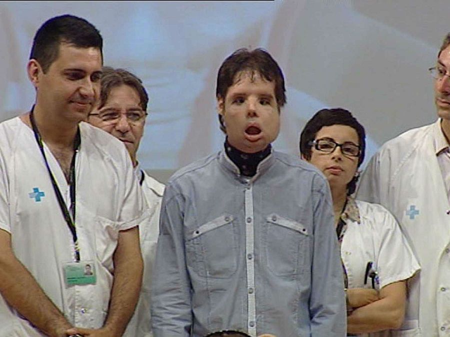 El doctor Barret y el paciente trasplantado en 2010