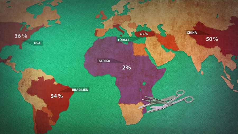 Porcentaje de cesáreas por países