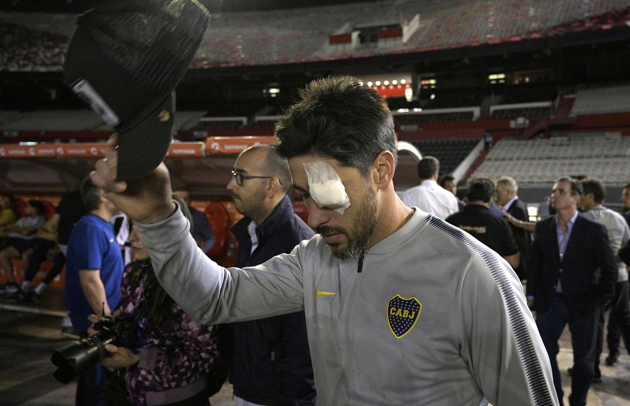 El jugador de Boca Juniors Pablo Pérez tras tener que ser atendido en la jornada del sábado.