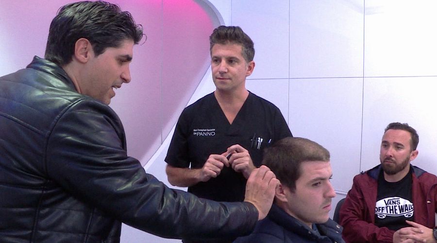 Implantes de pelo, una de las cirugías más demandadas