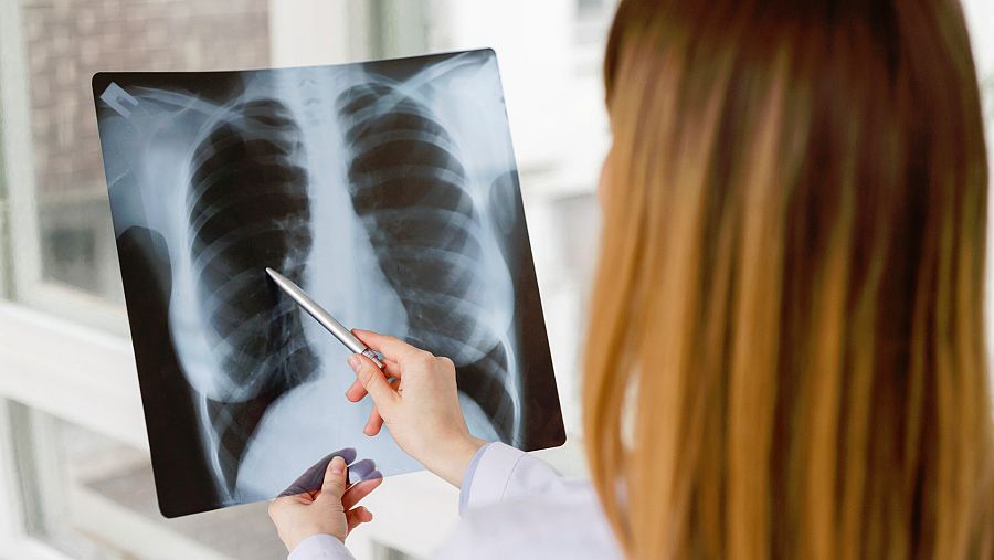 Los neumólogos alertan de que los cigarrillos electrónicos producen infecciones respiratorias, enre otras muchas enfermedades.