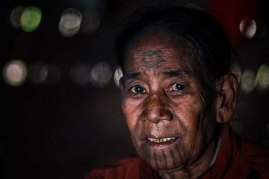 Kamor vive en la aldea de Wu Hta y está siendo tratado por MSF por asma actualmente