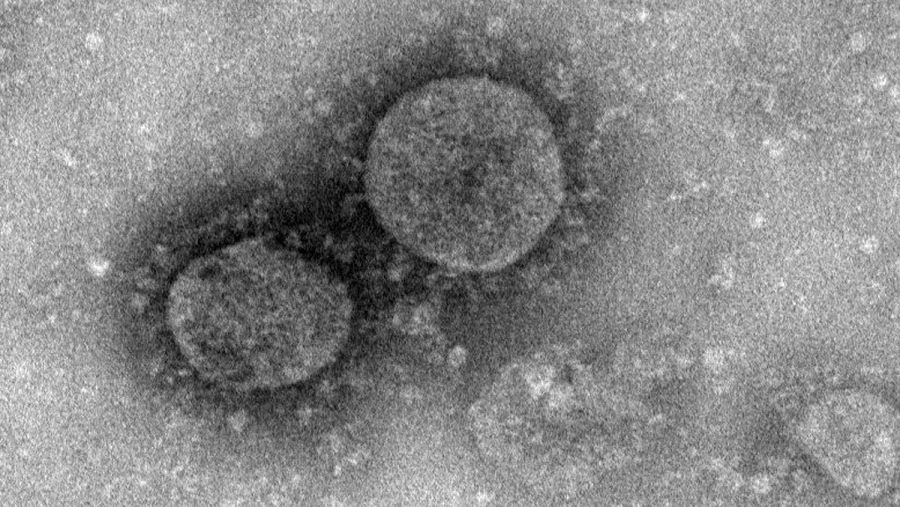 Imagen captada a través del microscopio del nuevo coronavirus
