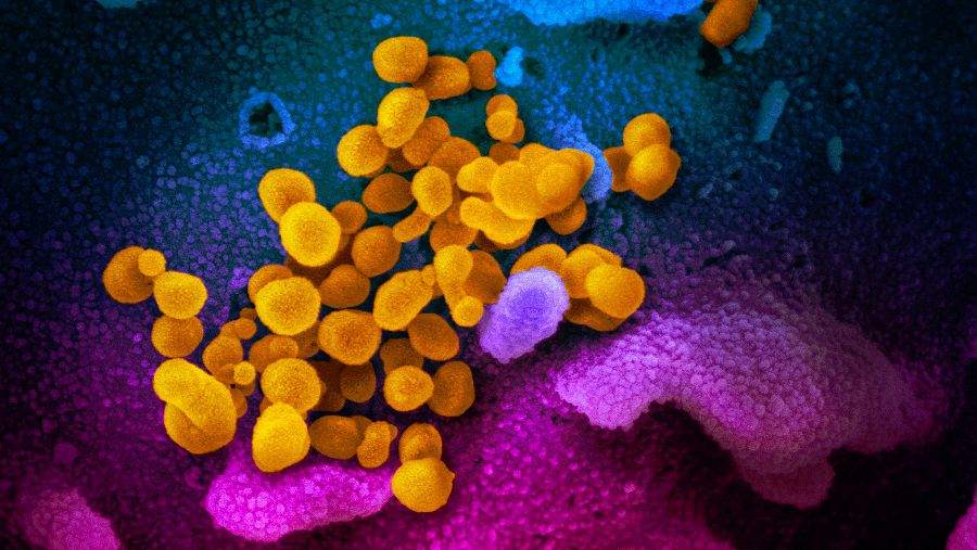 Coronavirus SARS-CoV-2, en amarillo, visto bajo microscopio.