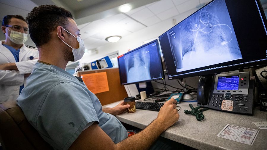 El nuevo coronavirus es un virus respiratorio, y como tal ataca con mayor agresividad a los pulmones.