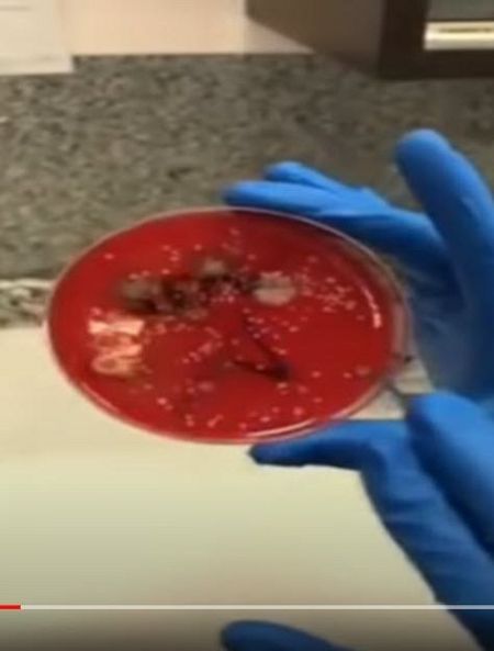 Muestra de una mascarilla utilizada tres semanas