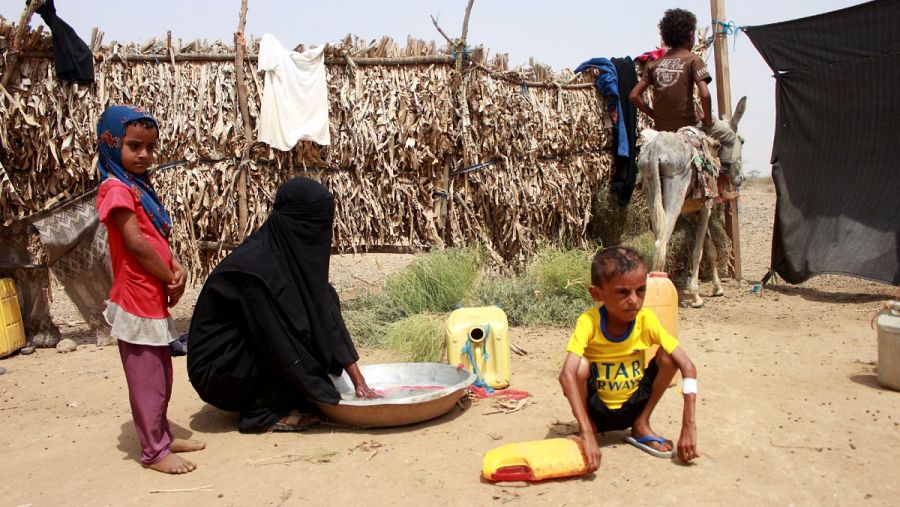 Un niño sufre desnutrición severa en Yemen, en el distrito de Hajjah, en una fotografía tomada el 17 de julio.