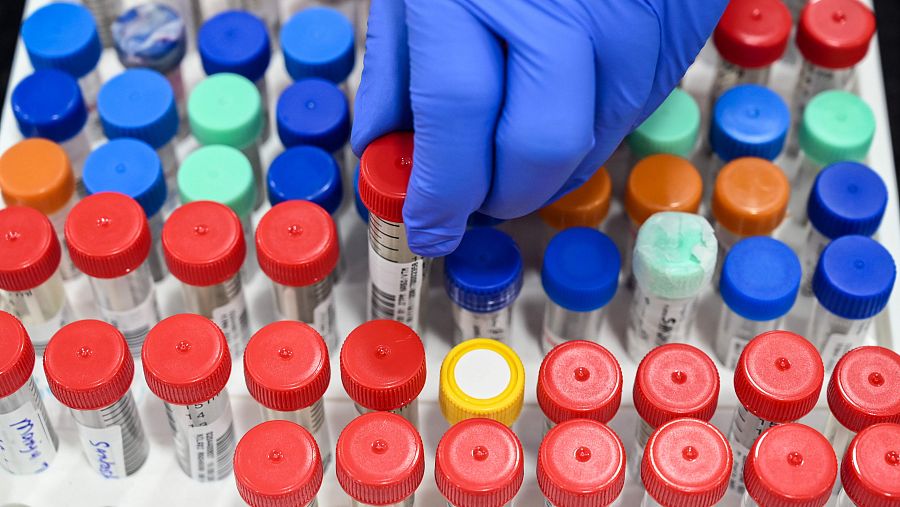 Sin una capacidad de diagnóstico efectiva, avanzar en la pandemia es como hacerlo a tientas.