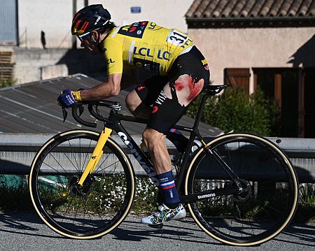 Así quedó el muslo de Primoz Roglic tras la primera caída