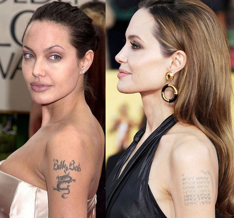 10 famosos que se borraron sus tatuajes ¡con remordimientos!