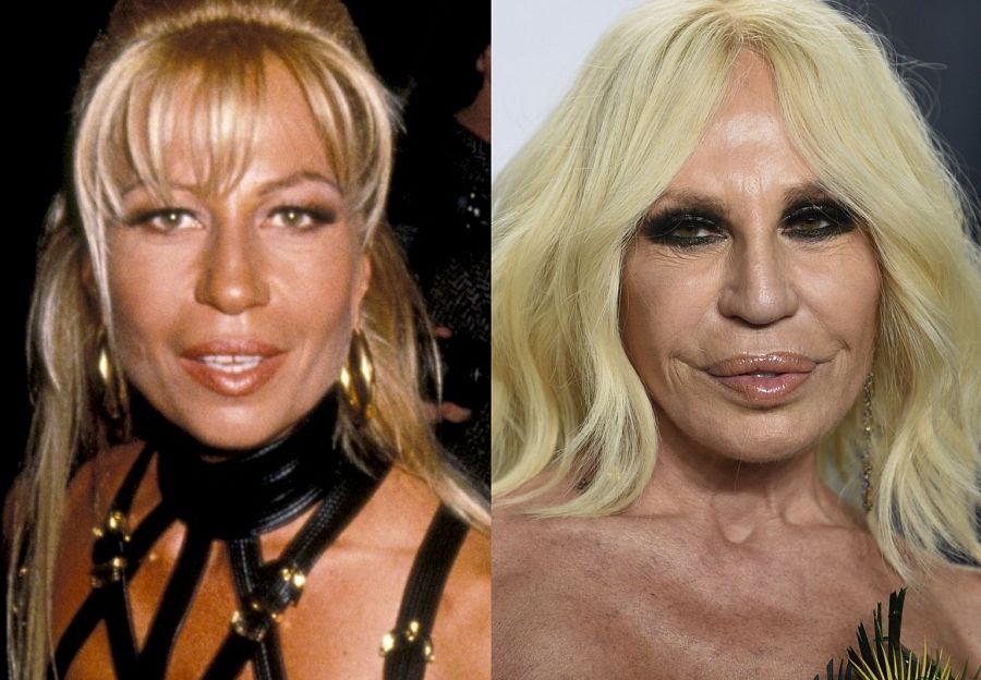 Donatella Versace.  Celebridades, Donatella versace, Celebridades antes e  depois