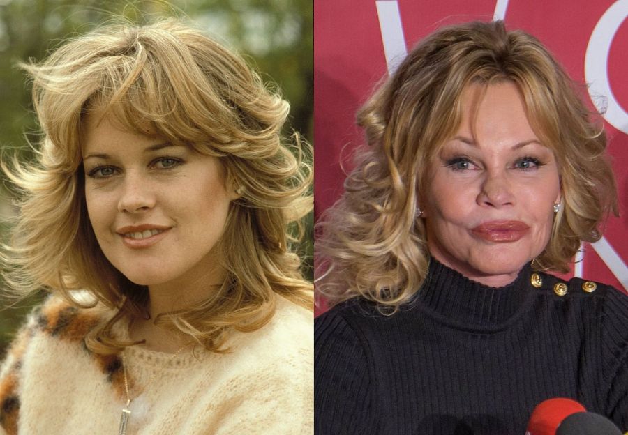 El antes y después de Melanie Griffith