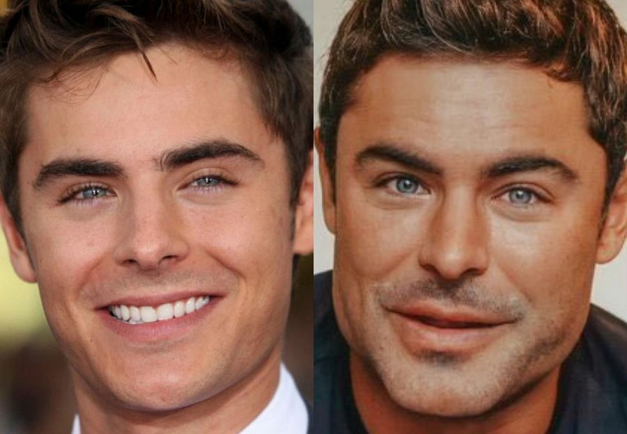 Antes y después de Zac Efron