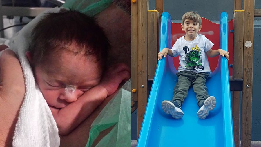 Bruno nació prematuramente, en la semana 33 de gestación, y ahora es un niño sano.