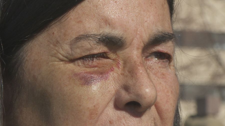 Agredida directora instituto de Burlada