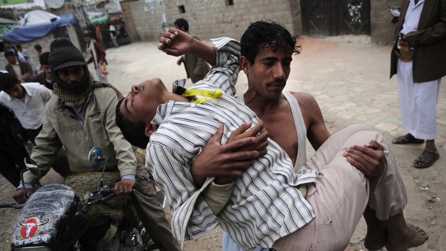 Joven herido durante las revueltas en Yemen en 2011