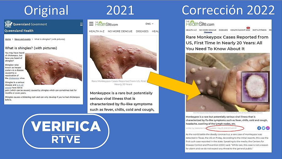 Error en fotografía viruela del mono con sello verifica
