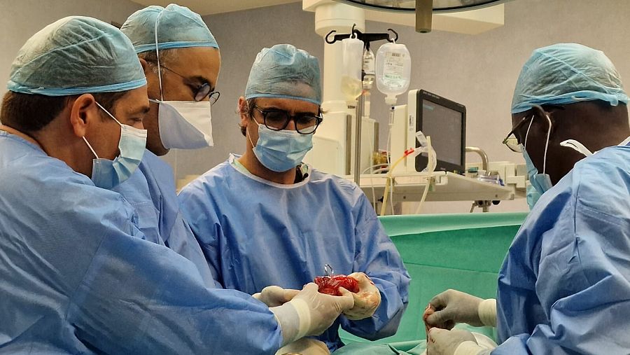 Cirujanos examinan el lóbulo de un pulmón después de una operación en el tórax