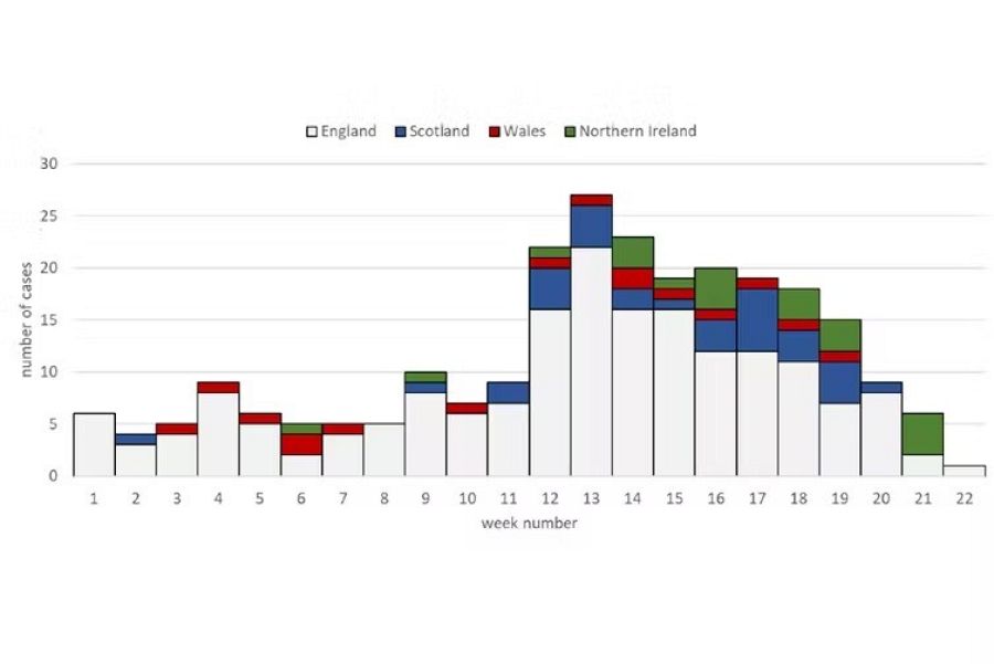 Casos de hepatitis aguda infantil