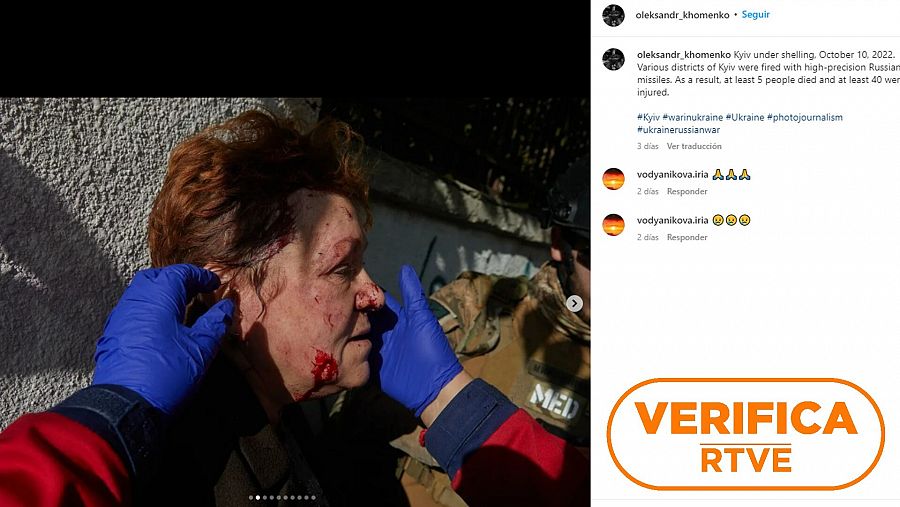 Publicación en Instagram del fotógrafo Oleksandr Khomenko que muestra la cara de la misma mujer a la que luego le aplican un vendaje y que es objeto del bulo que dice que sus heridas no son reales. Con el sello VerificaRTVE.