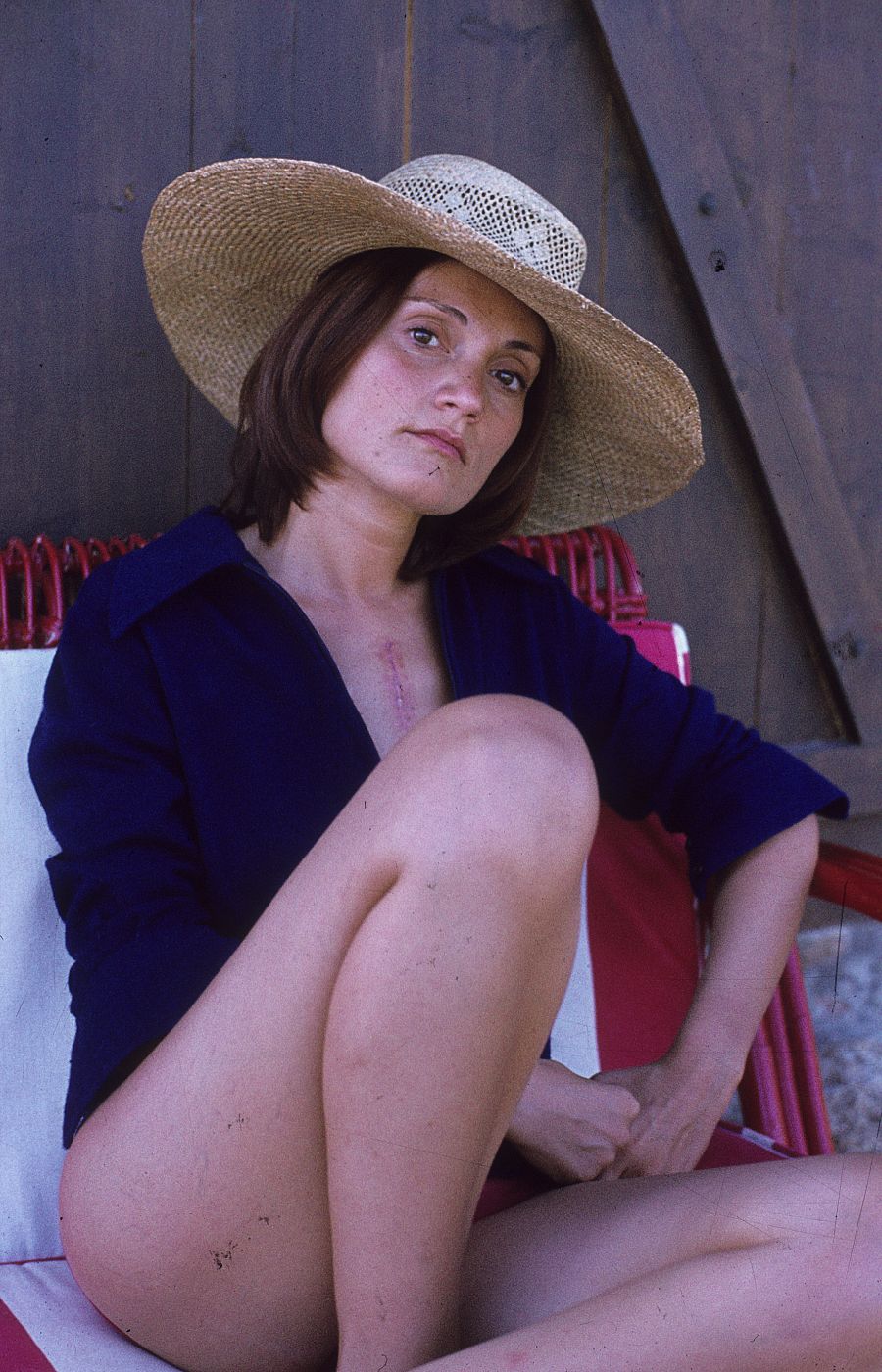 Pilar Miró en bañador, luce la cicatriz de una complicada operación a corazón